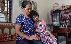 Mẹ chỉ ước cuộc sống bình thường cho đứa con mang “thân hình của quỷ”