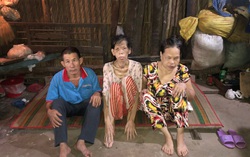 3 phận người trông vào 1 con mắt