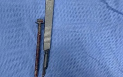 Người đàn ông bị bạn nhậu cắm đinh vít 6cm vào niệu đạo