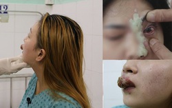 Làm đẹp đón Tết, người suýt mù mắt vì tiêm filler, người môi mưng mủ vì xăm
