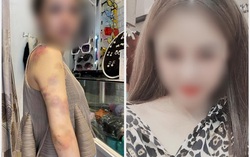 Người chồng bị vợ tố bạo hành ở Yên Bái: "Đúng là tôi có đánh vợ nhưng không nhốt"