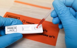 Chuyên gia lý giải vì sao giá test xét nghiệm Covid-19 khác nhau