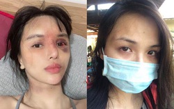 Trước siêu mẫu Khả Trang, nhiều sao nữ cũng từng bị bạo hành đến "thân tàn ma dại"