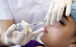 Tiêm filler ở spa, cô gái 25 tuổi bị hoại tử mũi và trán 