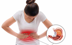 Giảm thiểu nỗi lo đau dạ dày bằng cách xây dựng lối sống khỏe mạnh