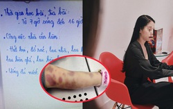 Mẹ ruột bé gái 8 tuổi bị bạo hành đến tử vong gửi đơn tố cáo 