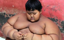 Cậu bé béo nhất thế giới từng nặng gần 200kg thay đổi ngoạn mục sau 3 năm
