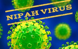 Chuyên gia nói gì về chủng virus Nipah có thể gây chết người gấp 75 lần virus SARS-CoV-2