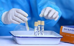 Bé 8 tuổi ở Hải Dương nhiễm Covid-19
