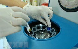 Ca nghi mắc Covid-19 ở Thanh Oai có kết quả xét nghiệm âm tính