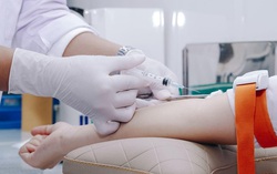 Hơn 1,6 triệu người dân sử dụng dịch vụ lấy mẫu xét nghiệm tại nhà