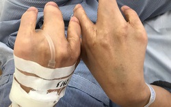 Nữ sinh 17 tuổi có phủ tạng đảo ngược, tim nằm bên phải