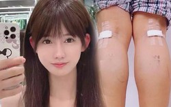 Cắt dây thần kinh để làm chân thon - phương pháp làm đẹp rùng rợn của giới trẻ