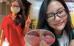 Thi cử căng thẳng, Phương Mỹ Chi chụp cận cảnh làn da "toang mạnh" ai nấy đều thương