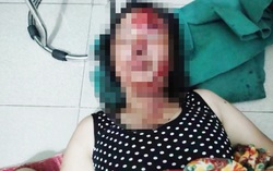 Hải Dương: Điều tra nguyên nhân chồng chích điện, dìm vợ xuống nước