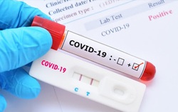 Kit test nhanh Covid-19: Mua loại nào, ở đâu đảm bảo? 