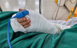 Nối thành công bàn tay người đàn ông bị chém đứt lìa