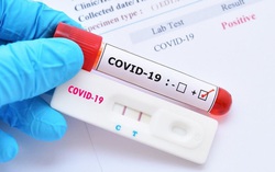 Thủ tướng yêu cầu Bộ Y tế công khai việc có hay không kit xét nghiệm phát hiện Omicron