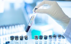 Công nghệ gene giúp phát hiện bệnh của trẻ ngay từ khi còn trong bụng mẹ