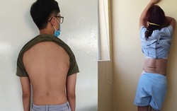 Báo động người trẻ mắc bệnh lý cơ xương khớp với nhiều biến chứng nguy hiểm 