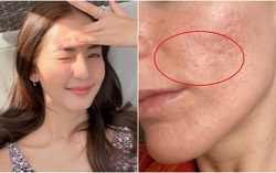 Trẻ hóa da tuổi 35+: Tập trung 5 bước giúp tăng sinh collagen và làm mờ nếp nhăn