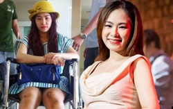 Từng bị bỏng cấp độ 2, Lương Bích Hữu trở lại ấn tượng không cần son phần