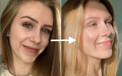 Chống lão hóa tuổi 30+: Bước chăm sóc then chốt bác sĩ khuyên nên làm