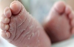 Bong tróc da tay chân ở trẻ em do đâu? Cha mẹ cần làm gì?