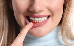 Nữ quản lý 31 tuổi bị ung thư nhưng không đau, không ngứa, bác sĩ nhắc chú ý 3 điều