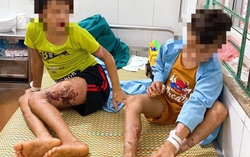 Liên tiếp trẻ bị tai nạn thương tích: Khuyến cáo của chuyên gia