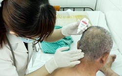 Bệnh nhân mắc vảy nến bị biến chứng nặng do mua thuốc trên mạng điều trị