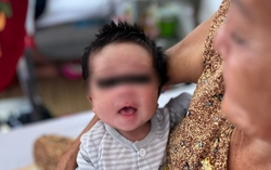 Cứu sống bé 16 ngày tuổi sốt cao, rốn lồi lên do mẹ không tiêm ngừa trong thai kỳ