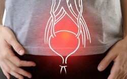 Tìm hiểu hội chứng bàng quang tăng hoạt vào mùa đông