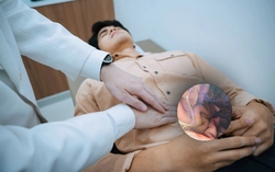 Bác sĩ nhắc nhở 6 món hải sản có nguy cơ cao nhiễm ký sinh trùng