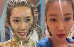 Dùng mẹo dân gian trị bỏng, Thúy Ngân phải bịt kín cổ