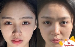 Cô gái có màn thay đổi làn da ngoạn mục nhờ đi ngủ