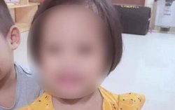 Bé 3 tuổi bị ghim 9 đinh vào đầu tiên lượng nặng
