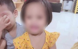 Bé 3 tuổi bị ghim 9 đinh vào đầu vẫn đang trong tình trạng nặng