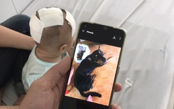Bé gái 6 tháng tuổi bị "chó cưng" cắn xuyên sọ