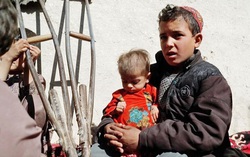 Thảm kịch của những đứa trẻ suy dinh dưỡng ở Afghanistan