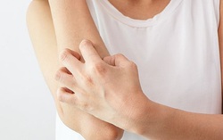 Dị ứng thời tiết có thể ảnh hưởng đến bạn như thế nào?