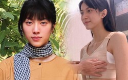 Người mẫu lưỡng tính kể chuyện đi nâng ngực