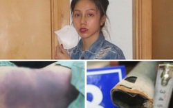 Vụ cha ruột và người tình bạo hành bé 8 tuổi đến tử vong: Mỗi người bị đề nghị truy tố 2 tội danh