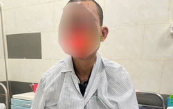 Bệnh nhân bị cháy sém, nguy cơ mù khi vừa dùng điện thoại vừa sạc