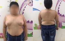 Mẹ sốc nặng khi con trai 9 tuổi phải uống thuốc cả đời vì thói quen thường gặp