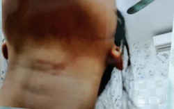 Công an điều tra vụ bố dượng bị tố bạo hành con riêng của vợ