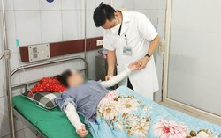 Bóng bay phát nổ, nữ sinh 15 tuổi bị bỏng vùng mặt và tay