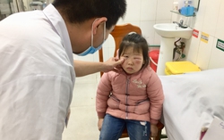 Mắt sưng to hơn do người nhà dùng nước lá trầu không rửa mắt
