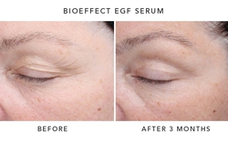 Ứng dụng công nghệ Peptide trong chăm sóc da