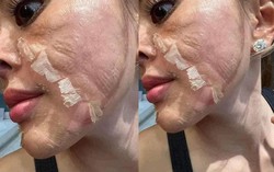 3 nguyên tắc peel da chị em cần nhớ